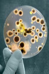 Does Vinegar Kill Germs?