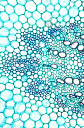 Diffusion, Membranes, and Cryogenics: Can We Freeze Cells?